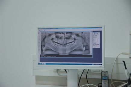 Röntgenaufnahme in der Zahnarztpraxis von Dr. Martin Smetan